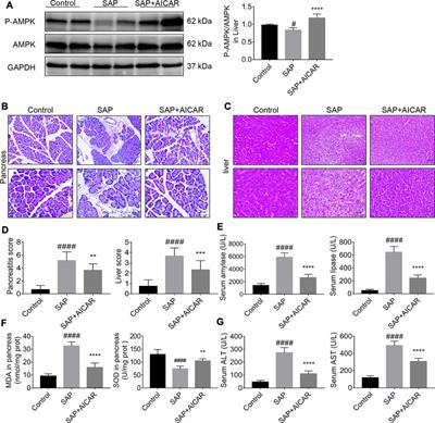 AICAR, an AMP-Activated Protein Kinase Activator, Ameliorates Acute Pancreatitis-Associated Liver Injury Partially Through Nrf2-Mediated Antioxidant Effects and Inhibition of NLRP3 Inflammasome Activation